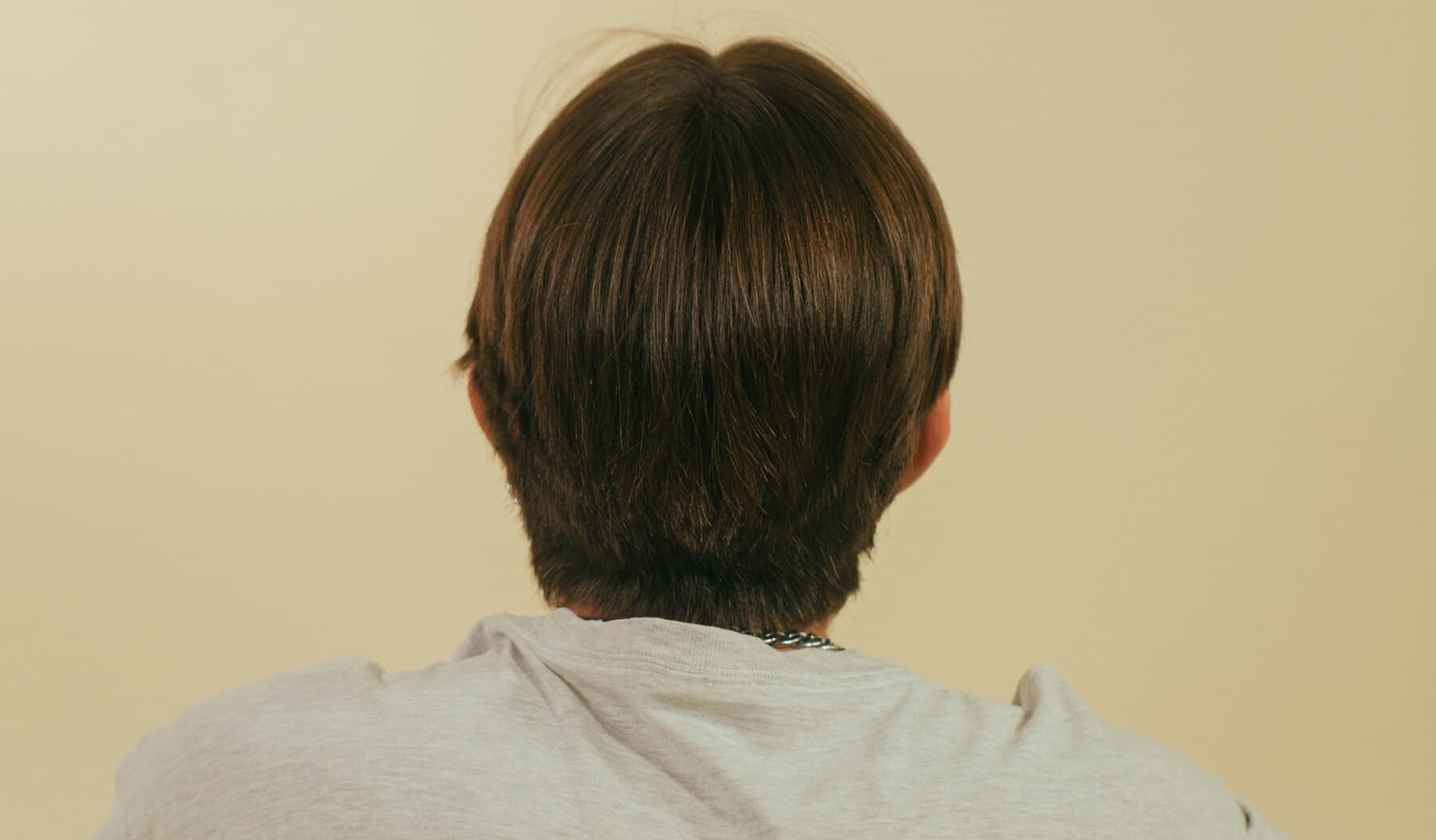 Hair Loss in Trans Men: Causes, Timelines, and How to Treat It